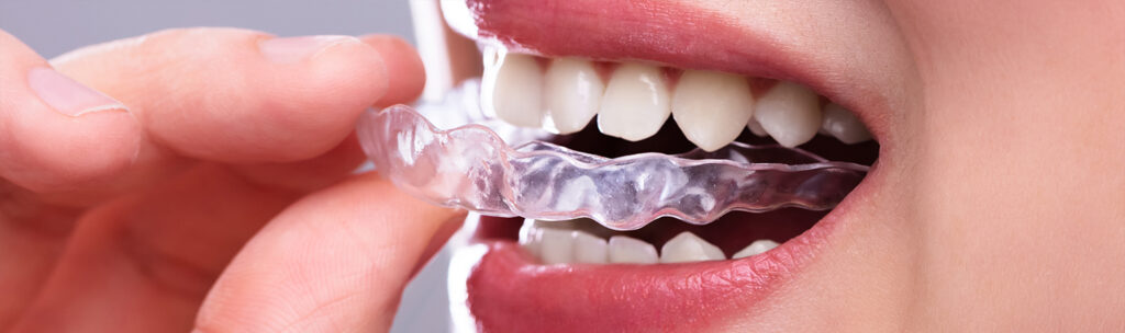 bruxism apps and night guards